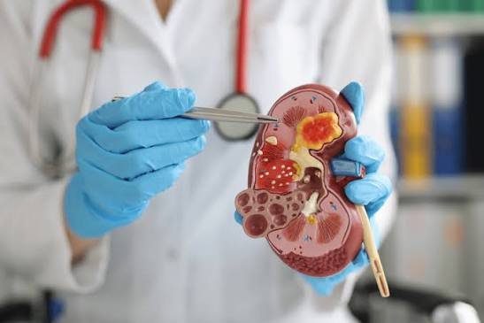 Doença renal crônica: estudo aponta falhas no diagnóstico no Brasil